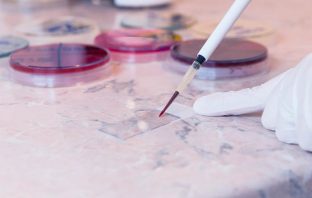 Feds Not Properly Monitoring Immigrants at Risk for Carrying Zika